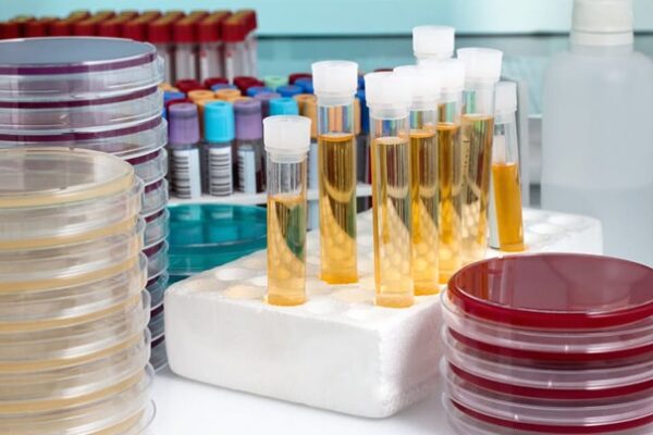 Consommables de laboratoire